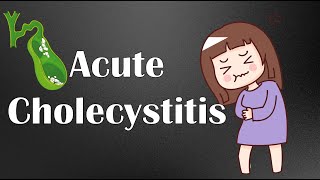 Acute Cholecystitis  Causes Symptoms Physical Signs Diagnosis amp Treatment [upl. by Eanyl706]