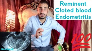 Level 3  Female pelvis  Obs  Emergency  Post abortion Reminent vs cloted blood [upl. by Selemas906]