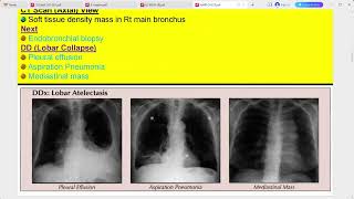 RADIOLOGY EXAM CASES [upl. by Eelsel]