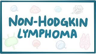 Nonhodgkin lymphoma  causes symptoms diagnosis treatment pathology [upl. by Nurse722]