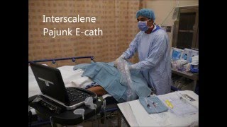 USG Interscalene Catheter Insertion Pajunk Ecath  OutOfPlane Technique [upl. by Wavell]