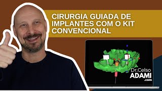 GUIA PARA CIRURGIA DE IMPLANTES NO BLUESKYPLAN UTILIZANDO SEU KIT CONVENCIONAL  TUTORIAL COMPLETO [upl. by Melania]