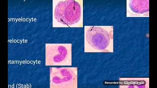 Leukopoiesis formation of White Blood Cells [upl. by Eiuqram139]