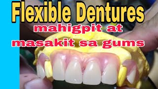 Flexible Dentures pwede ba Sayo o hindi [upl. by Hadwyn508]