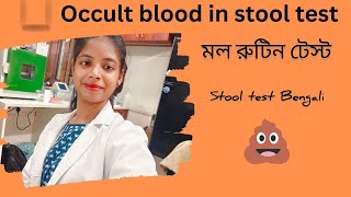 মল রুটিন টেস্ট Occult blood in stool test খুব সহজ পদ্ধতিতে জেনে নিন মল পরীক্ষা কিভাবে করা হয়💩 [upl. by Orelu342]