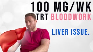 My Blood Work on 100mg Testosterone per Week [upl. by Toms]