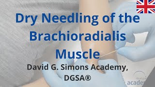 How to treat the Brachioradialis Muscle with Dry Needling  David G Simons Academy DGSA® [upl. by Ahsiner]