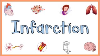 Infarction  Causes Types Morphology amp Factors influencing development of infarction [upl. by Mahoney]