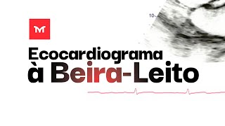 Ecocardiograma à BeiraLeito [upl. by Ahsirpac]