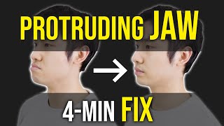 Protruding Jaw  Underbite Fix ｜Facial Asymmetry Correction｜Corrective Exercises [upl. by Lingwood]