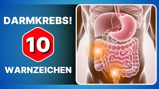 10 Symptome die zeigen dass Sie dringend eine Koloskopie machen müssen [upl. by Rolanda213]