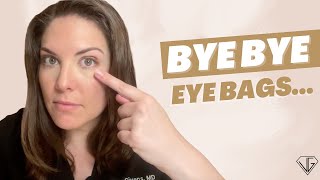 How to QUICKLY Get Rid of Your Eye BAGS For Good [upl. by Newberry]