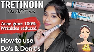 Tretin  Retino A  Tretinoin cream for Acne Anti aging  Best product I ever used  Medic Akanshya [upl. by Renato]