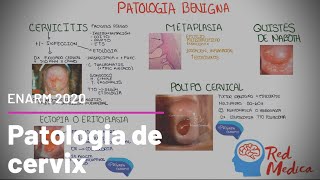 Cancer cervicouterino CaCU cervicitis y otra patología de cervix ENARM [upl. by Yriek25]