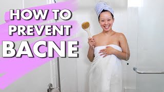 how to prevent back acne pregnancy vlogs [upl. by Osnofedli]