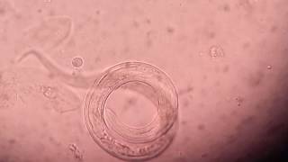 Live Strongyloides under sputum saline wet mount [upl. by Hanley]