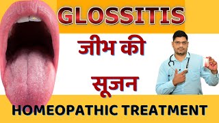 Glossitis Homeopathic Treatment  Jeebh Par Sujan Aana  Dr Sunil Patidar [upl. by Sudnak]