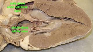 chordae tendineae [upl. by Nosirrag]