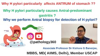 Why H pylori causes Antral predominant gastritis amp particularly affects antrum of stomach hpylori [upl. by Phineas736]