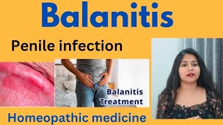 Balanitis penile infection treatment  Balanitis symptomscauses amp homeopathic medicine in hindi [upl. by Anirret]