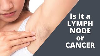 Could The Lump In My Armpit Be A Lymph Node Or Cancer Lymphoma [upl. by Carrnan]