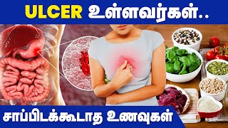 Ulcer பிரச்சனை உள்ளவர்கள் சாப்பிடக்கூடாத உணவுகள் இது தான்  Ulcer Patient Avoid Food in Tamil [upl. by Fulton]