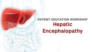 Workshop  Hepatic Encephalopathy [upl. by Iclek]