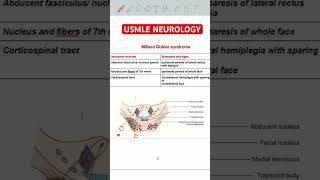 Millard Gubler syndrome usmle usmlepreparation usmlestep1videos [upl. by Leimaj]