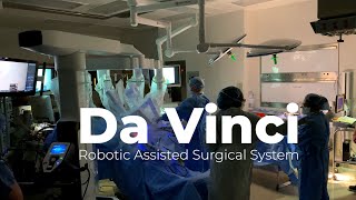 Da Vinci robotic assisted surgical system [upl. by Huberman]