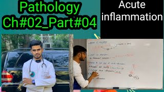 ACUTE INFLAMMATION44PathologyCh02Part04 [upl. by Sucramel]