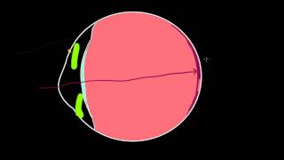 Common disorders of the eye and NCLEX style practice questions [upl. by Lana591]