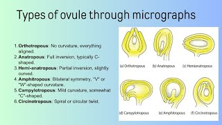 types of ovule  Bsc [upl. by Ybloc]