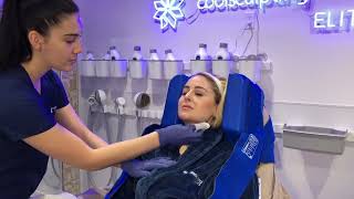 Treating double chin with Coolsculpting Elite [upl. by Ybanrab]