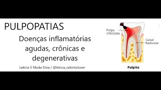 Pulpopatias  Doenças inflamatórias agudas crônicas e degenerativas da polpa [upl. by Enytsirhc193]