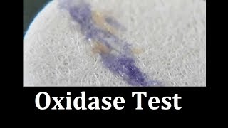 Oxidase test Protocol [upl. by Kcerb]