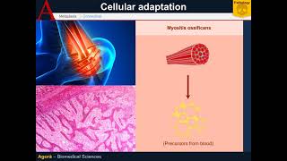 Cellular Pathology  Metaplasia [upl. by Ecyor]