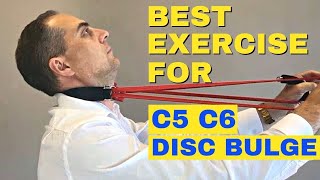 Best Exercises For C5 C6 Bulging Disc  C5 C6 Herniated Disc Exercises by Dr Walter Salubro [upl. by Sullecram363]