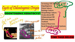 Odontogenic Keratocyst PART 1 DETAILED Clinical and Radiologic features Gorlin Goltz SYNDROME [upl. by Tedman]