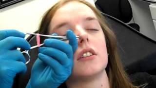 Double Nostril Piercing 2 in 1 sitting [upl. by Shapiro625]