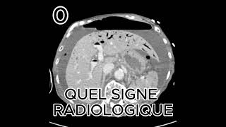 AEROPORTIE radiologystudent science femmemedecine [upl. by Harley]