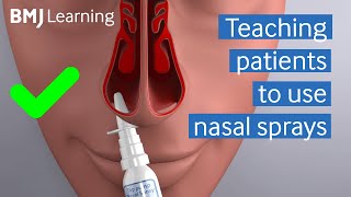 Teaching patients to use nasal sprays  BMJ Learning [upl. by Euqinehs]