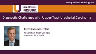 Diagnostic Challenges with UpperTract Urothelial Carcinoma [upl. by Enenaej]