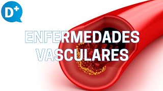 Consejos para prevenir las enfermedades vasculares [upl. by Edualcnaej]