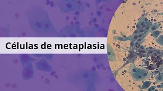 Metaplasia ¿Qué significa [upl. by Bowne860]