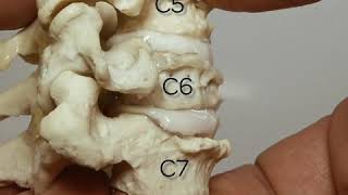 Dynamic Cervical Spinal Stenosis Model  Human Anatomical Disc [upl. by Naesyar]