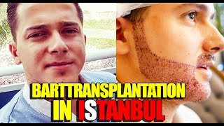 BARTTRANSPLANTATION IN ISTANBUL  VLOG  ENGLISH SUBTITLES [upl. by Yelsgnik922]