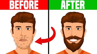 How to Deal With a Patchy Beard [upl. by Alarise847]