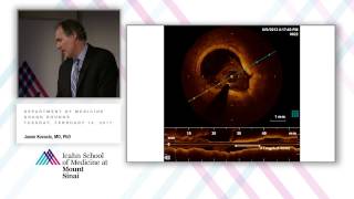 Defining the Cause of FMD and Redefining Our Understanding of Spontaneous Arterial Dissection [upl. by Platas]