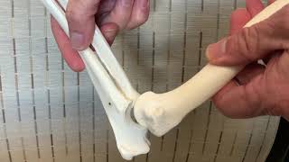 Canine elbow dislocation reduction [upl. by Luisa]