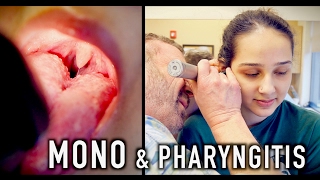 MONO amp PHARYNGITIS Crazy Story  Dr Paul [upl. by Ecirtap641]